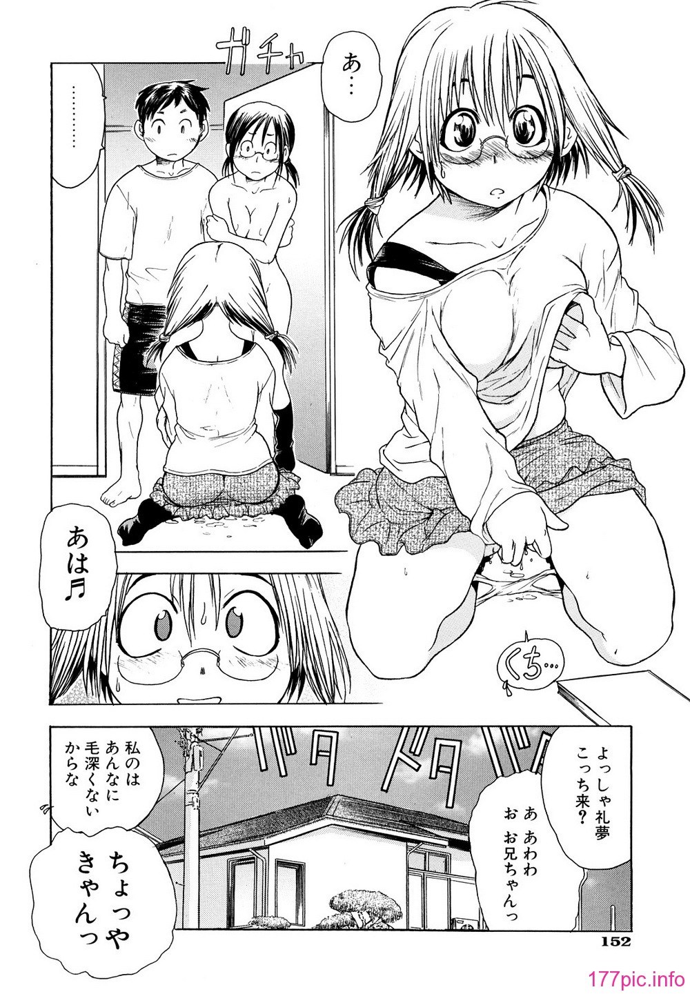 155
