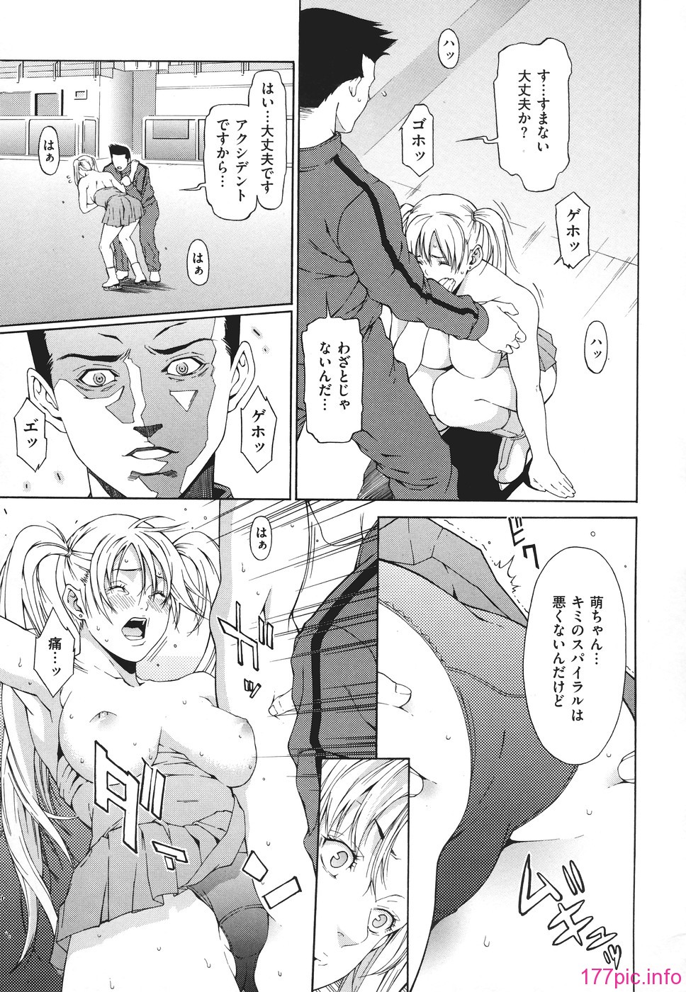 151