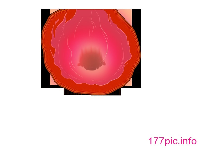 271