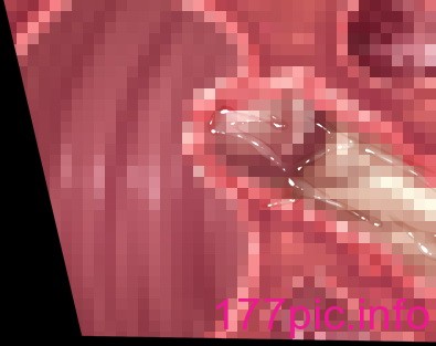 1254
