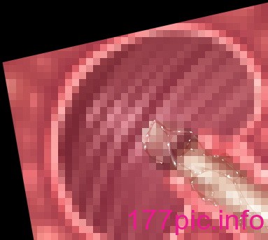 1442