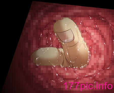 2957