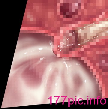 584