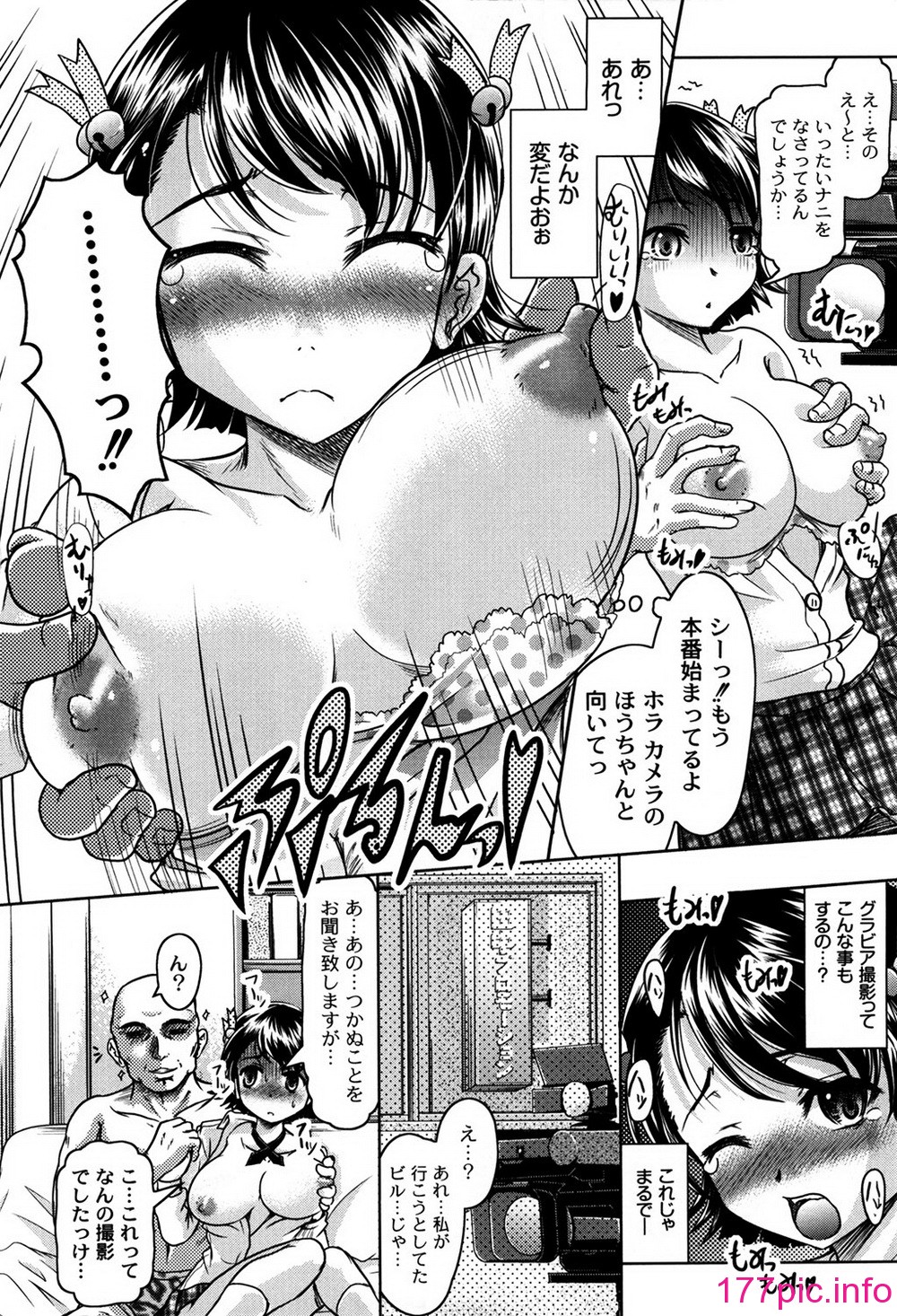 151