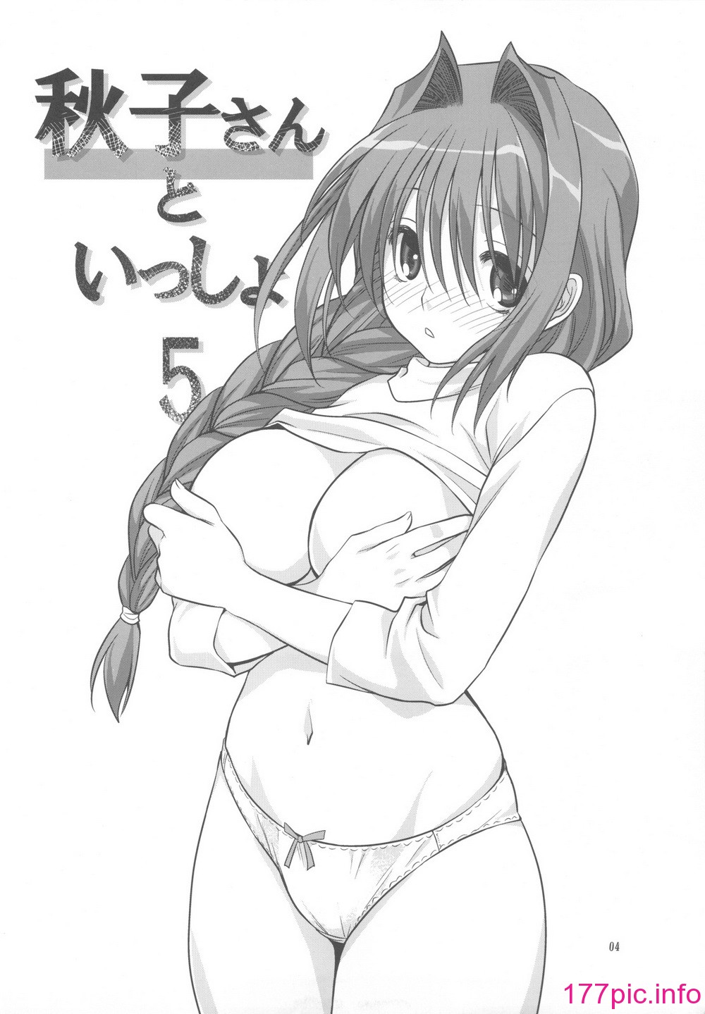 151
