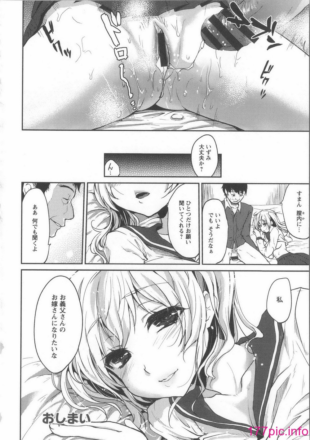 155