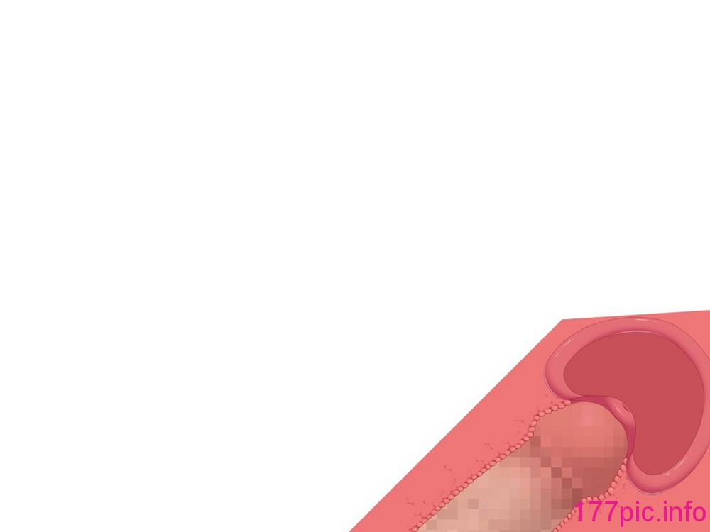 022