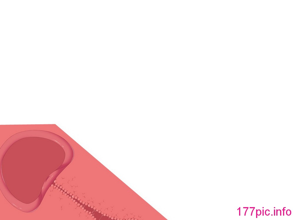 070