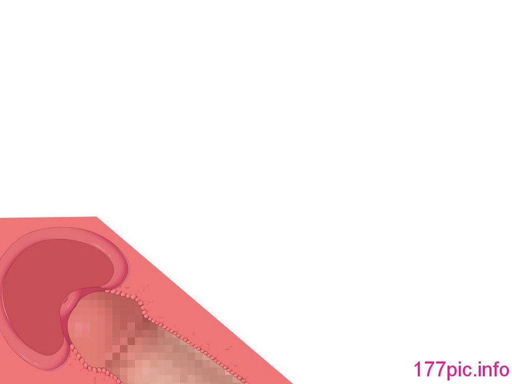 071