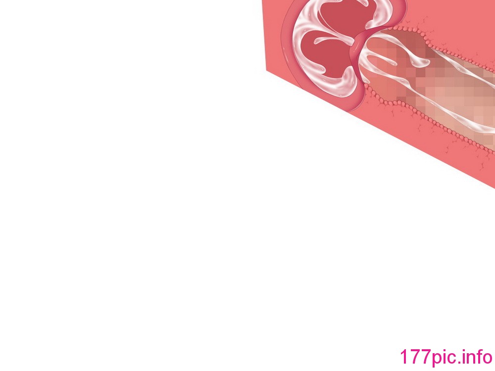 081