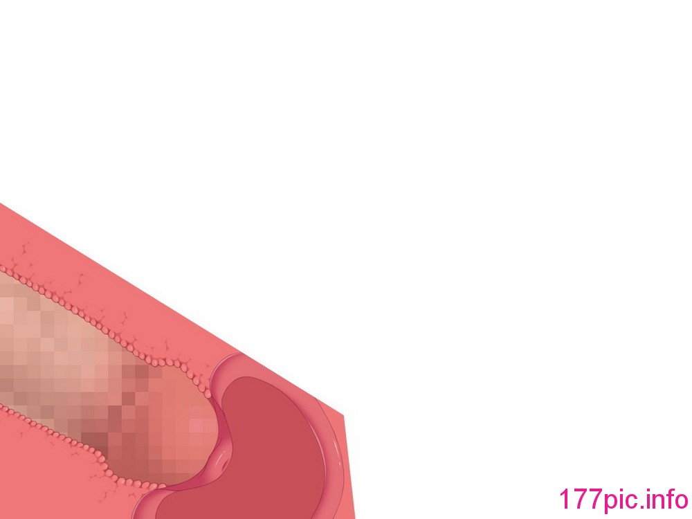 091